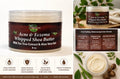 Acne & Eczema Whipped Shea Butter